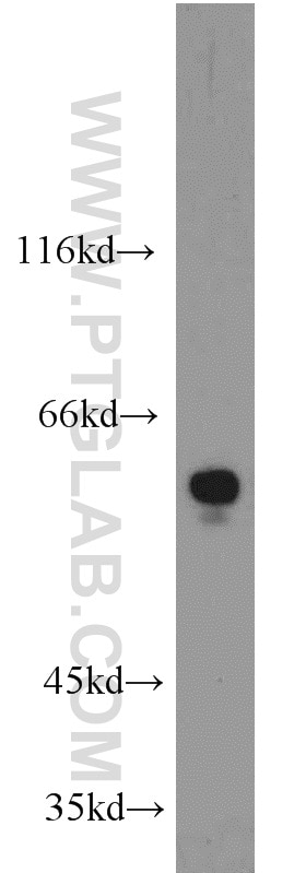 Western Blot (WB) analysis of MCF-7 cells using RAD9A Polyclonal antibody (13035-1-AP)