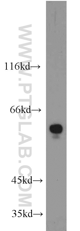 WB analysis of MCF-7 using 13035-1-AP