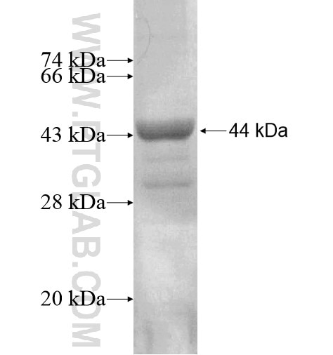 RAD9B fusion protein Ag14423 SDS-PAGE