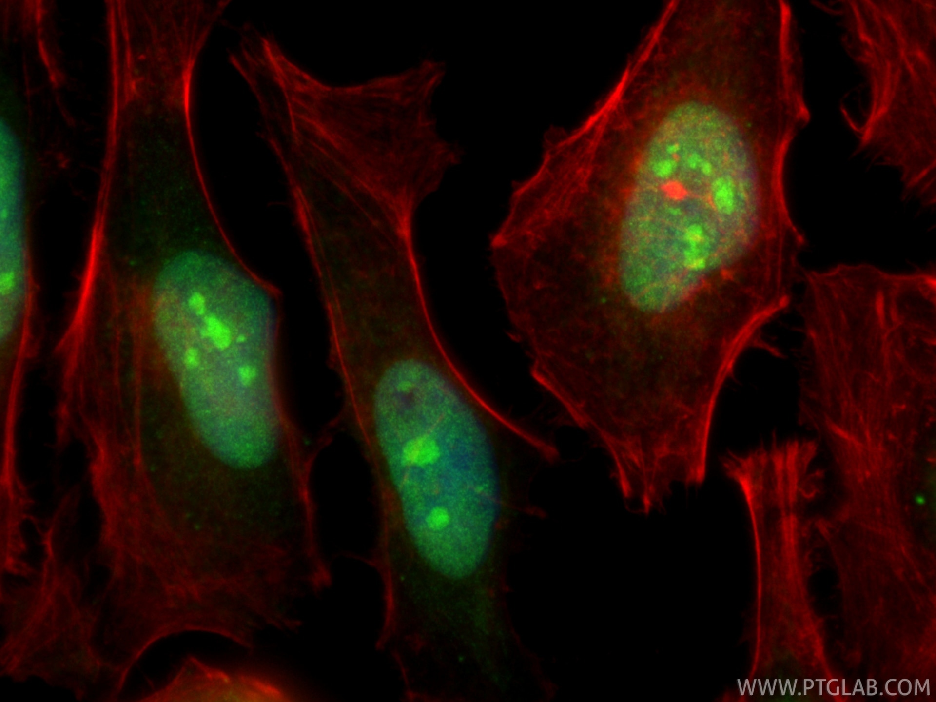 Immunofluorescence (IF) / fluorescent staining of HeLa cells using RADIL Polyclonal antibody (20284-1-AP)