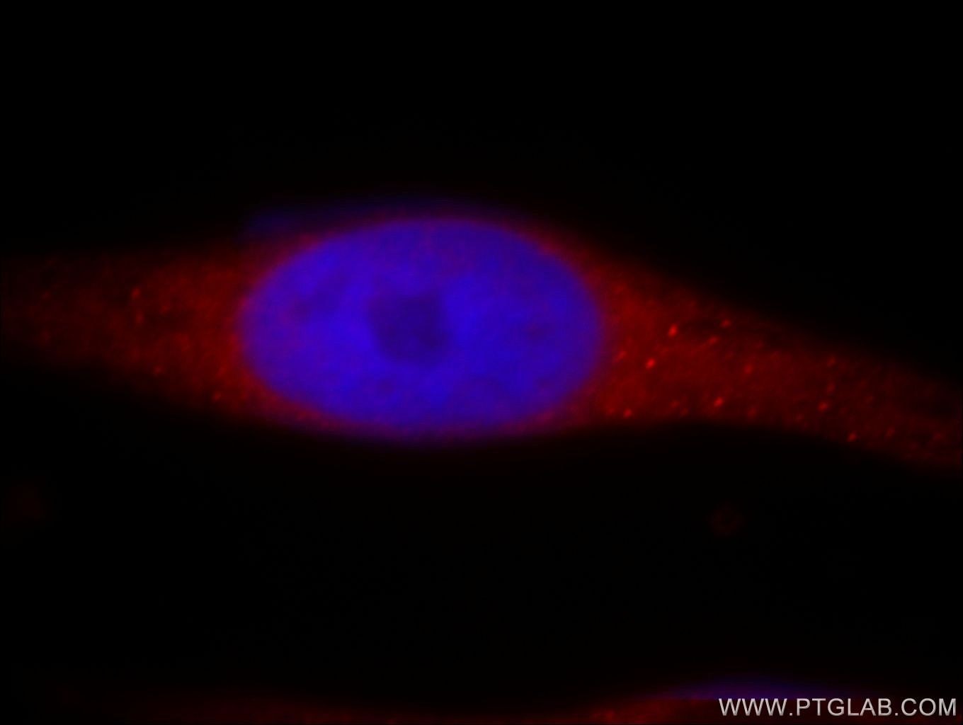 Immunofluorescence (IF) / fluorescent staining of HeLa cells using RADIL Polyclonal antibody (20284-1-AP)