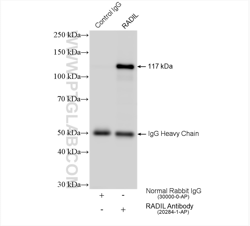 Immunoprecipitation (IP) experiment of HEK-293 cells using RADIL Polyclonal antibody (20284-1-AP)
