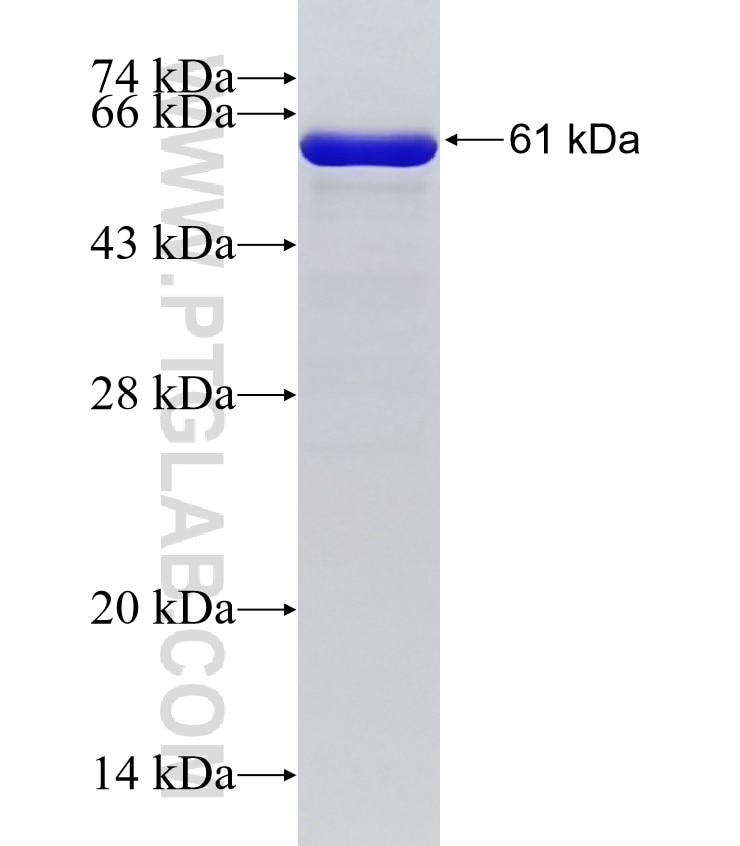 RADIL fusion protein Ag13996 SDS-PAGE