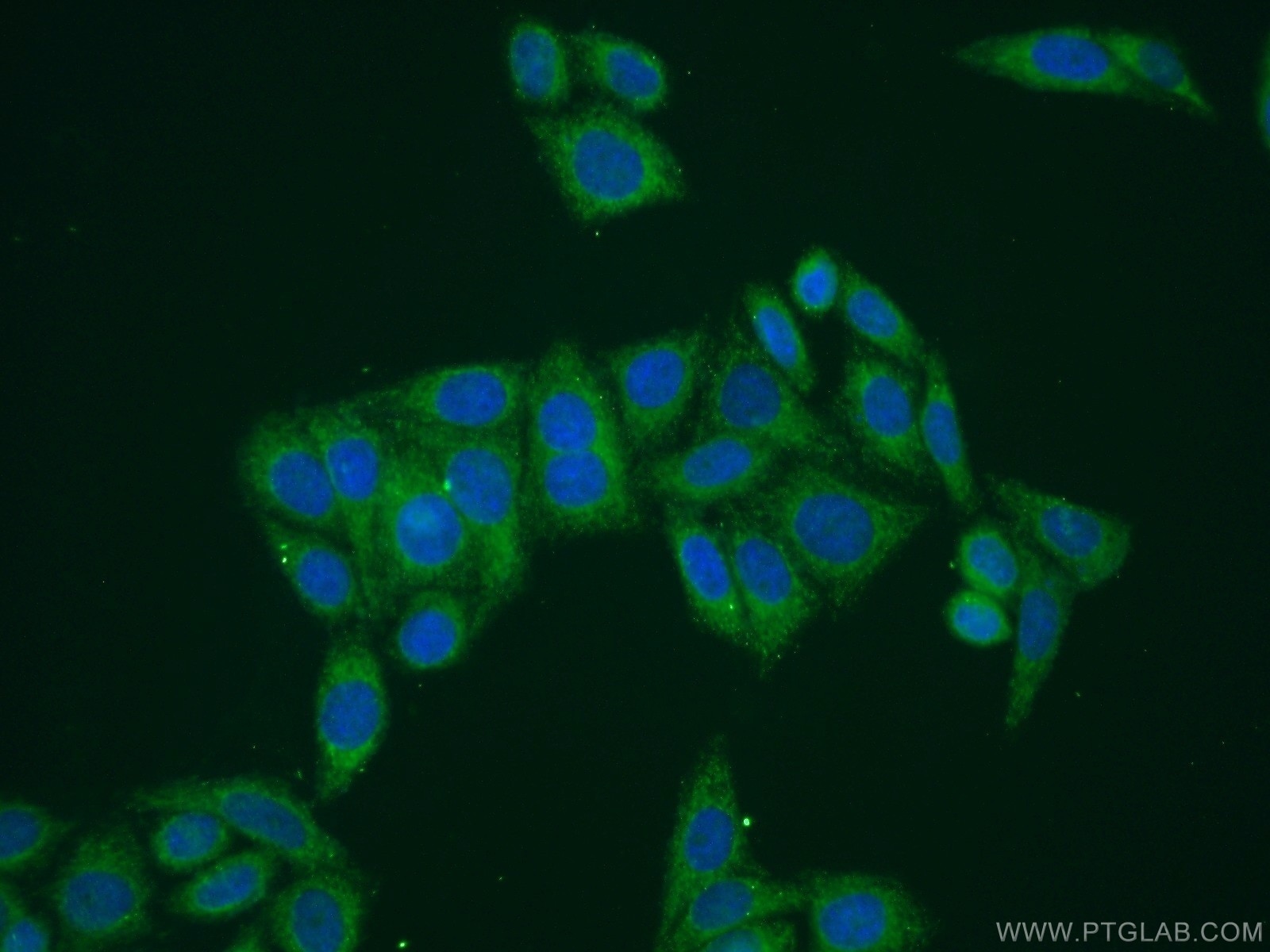 IF Staining of HepG2 using 20491-1-AP