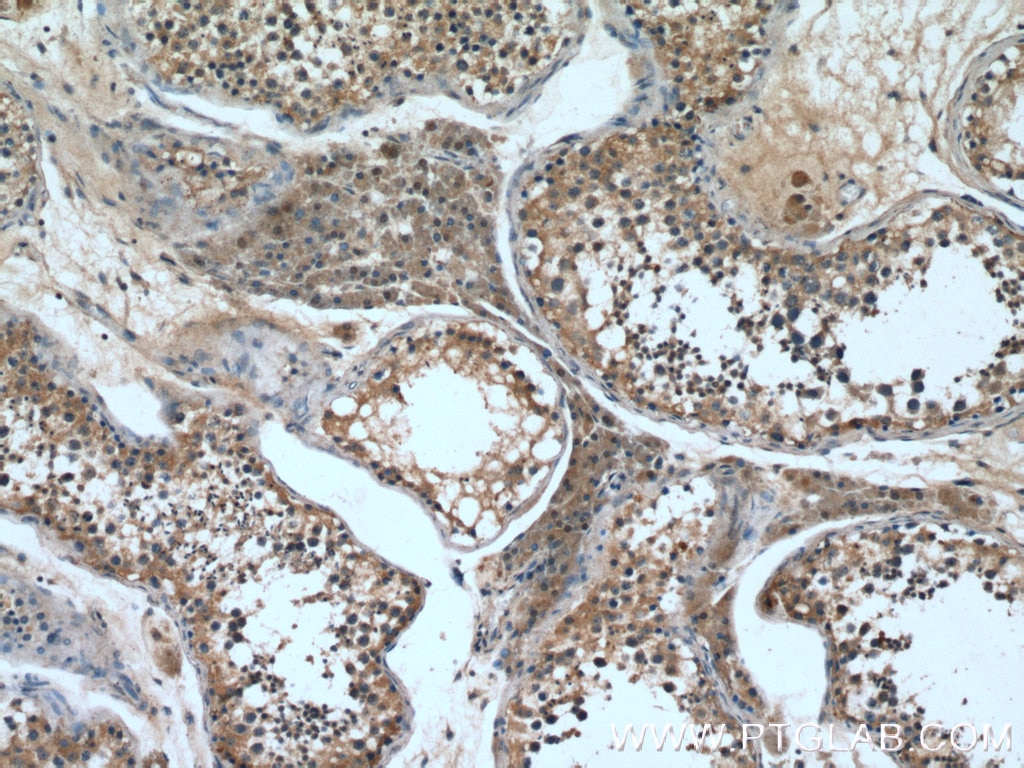 Immunohistochemistry (IHC) staining of human testis tissue using RAE1 Polyclonal antibody (20491-1-AP)