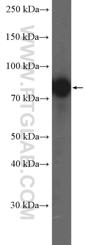 Western Blot (WB) analysis of DU 145 cells using RAF1 Polyclonal antibody (26863-1-AP)