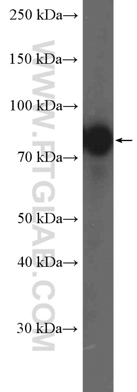 RAF1 Polyclonal antibody