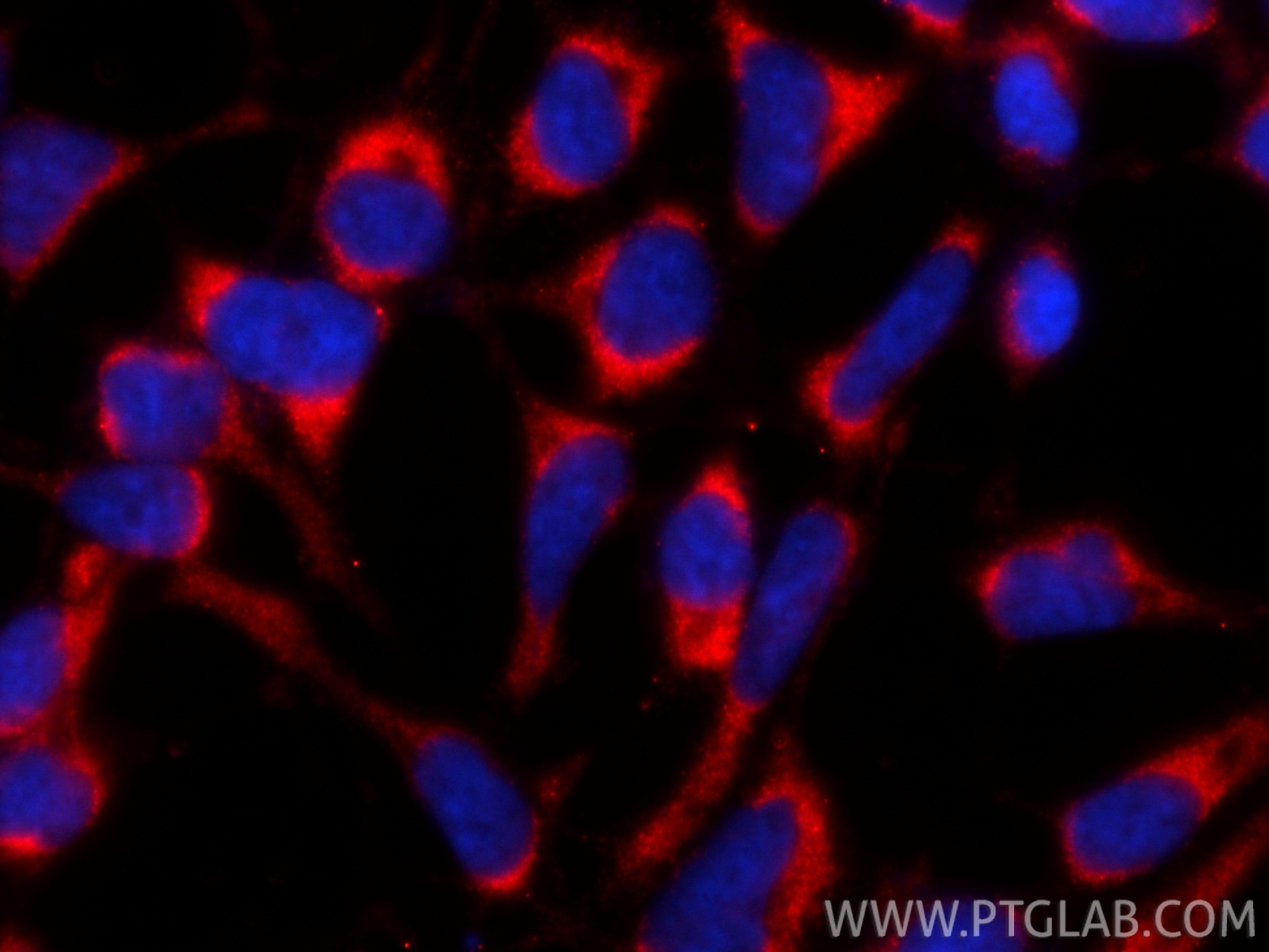 Immunofluorescence (IF) / fluorescent staining of HEK-293 cells using CoraLite®594-conjugated RAF1 Monoclonal antibody (CL594-66592)