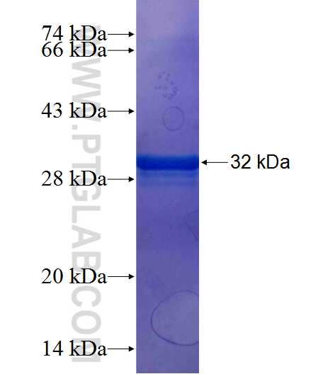 RAF1 fusion protein Ag25423 SDS-PAGE