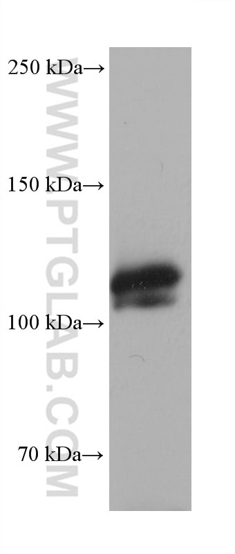 Western Blot (WB) analysis of various lysates using RAG1 Monoclonal antibody (68591-1-Ig)
