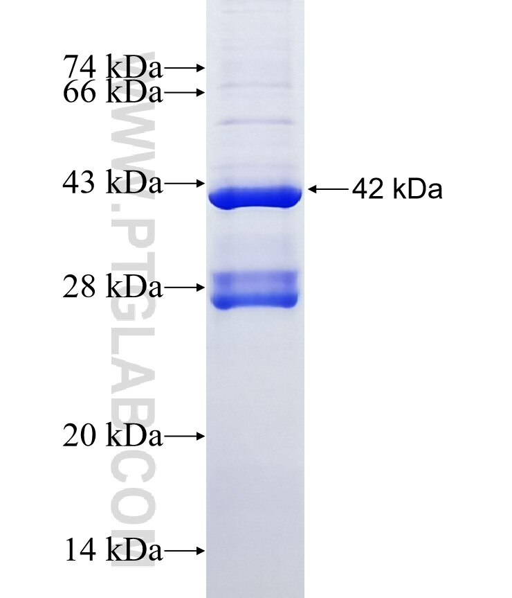 RAG1AP1 fusion protein Ag10350 SDS-PAGE