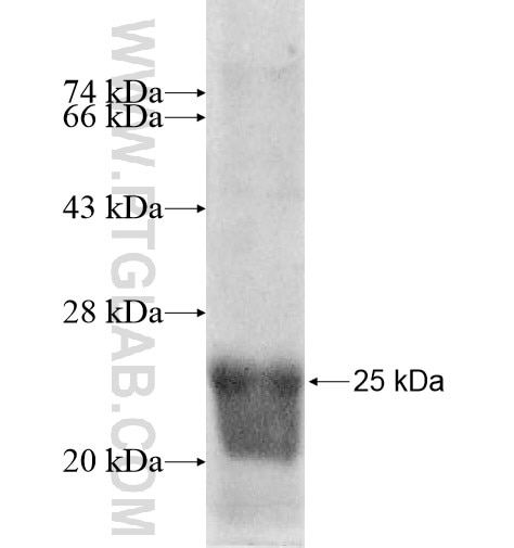 RAG1AP1 fusion protein Ag10476 SDS-PAGE