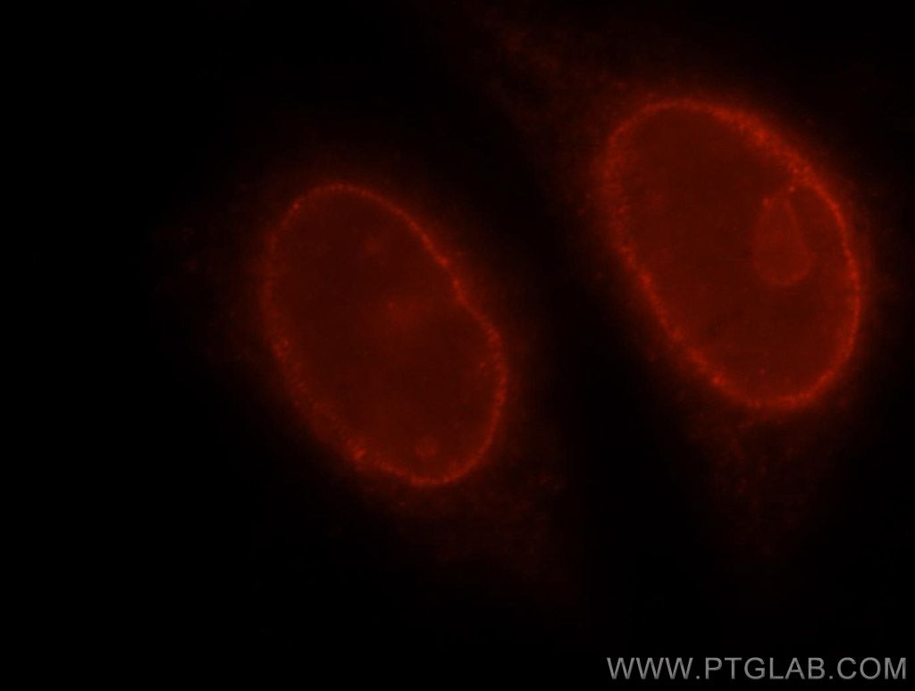 Immunofluorescence (IF) / fluorescent staining of HeLa cells using RAG2 Polyclonal antibody (11825-1-AP)