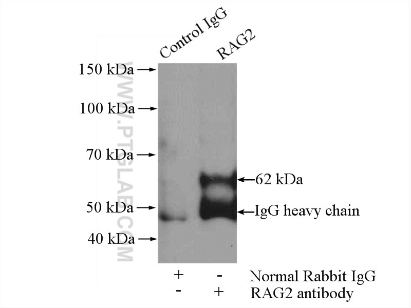 Immunoprecipitation (IP) experiment of A375 cells using RAG2 Polyclonal antibody (11825-1-AP)