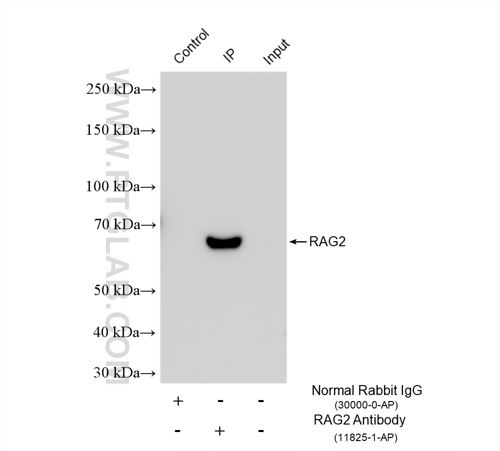 Immunoprecipitation (IP) experiment of mouse thymus tissue using RAG2 Polyclonal antibody (11825-1-AP)