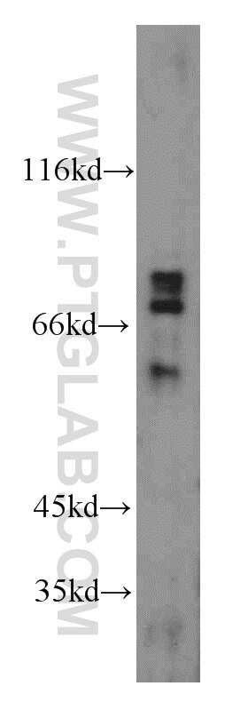 Western Blot (WB) analysis of mouse thymus tissue using RAG2 Polyclonal antibody (11825-1-AP)