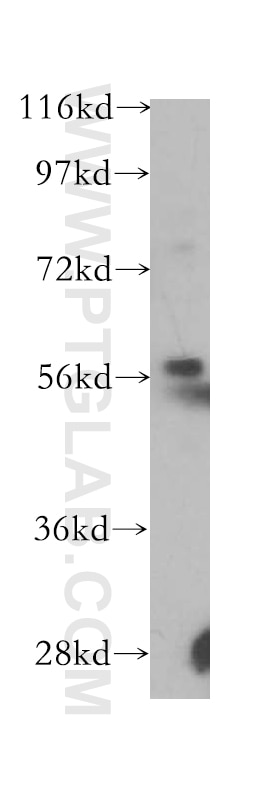 Western Blot (WB) analysis of A375 cells using RAG2 Polyclonal antibody (11825-1-AP)