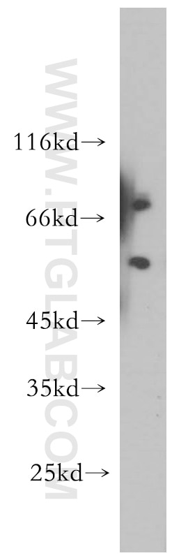 Western Blot (WB) analysis of A375 cells using RAG2 Polyclonal antibody (11825-1-AP)