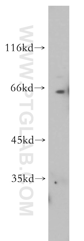 Western Blot (WB) analysis of mouse thymus tissue using RAG2 Polyclonal antibody (11825-1-AP)