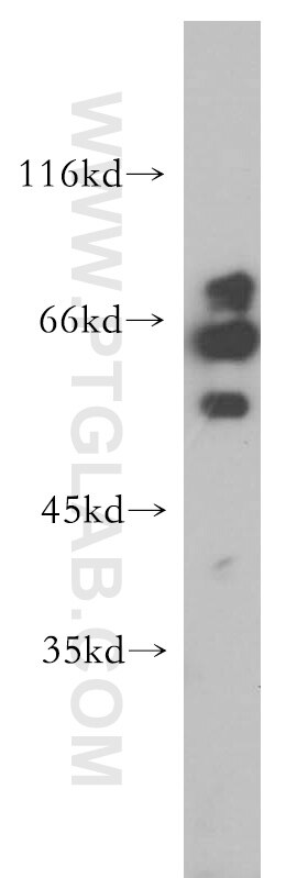 Western Blot (WB) analysis of mouse thymus tissue using RAG2 Polyclonal antibody (11825-1-AP)