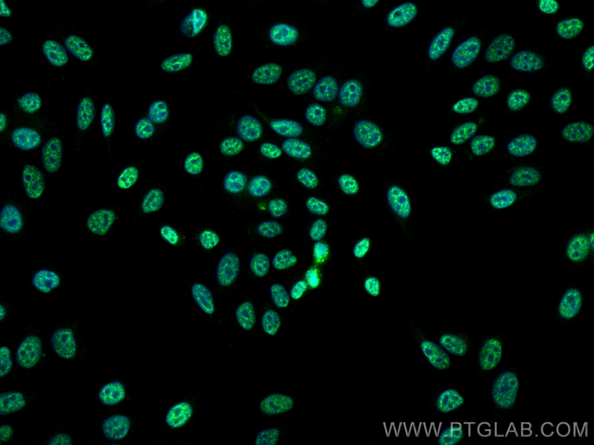 Immunofluorescence (IF) / fluorescent staining of HepG2 cells using RAG2 Monoclonal antibody (66998-1-Ig)