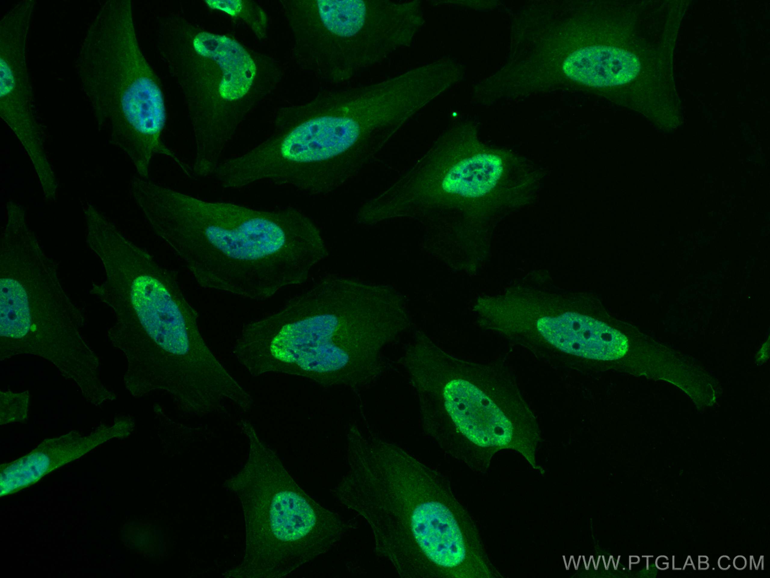 Immunofluorescence (IF) / fluorescent staining of HeLa cells using CoraLite® Plus 488-conjugated RAG2 Monoclonal anti (CL488-66998)