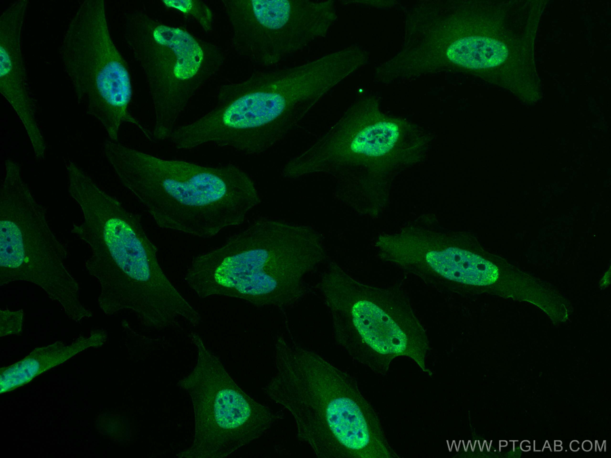 IF Staining of HeLa using CL488-66998