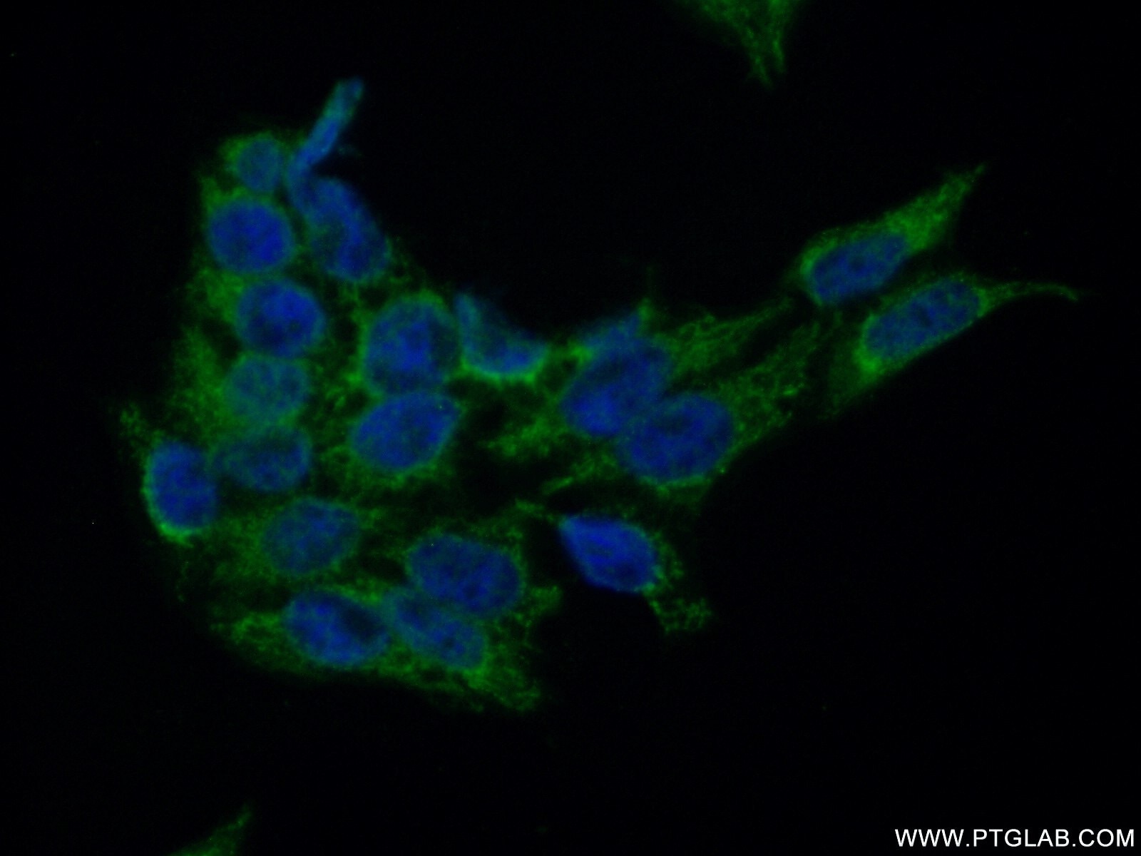 Immunofluorescence (IF) / fluorescent staining of HeLa cells using MOK Polyclonal antibody (23926-1-AP)