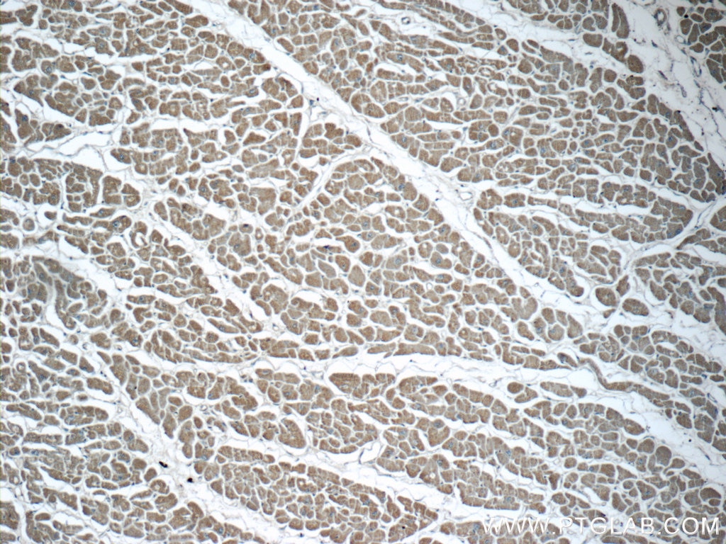 Immunohistochemistry (IHC) staining of human heart tissue using MOK Polyclonal antibody (23926-1-AP)