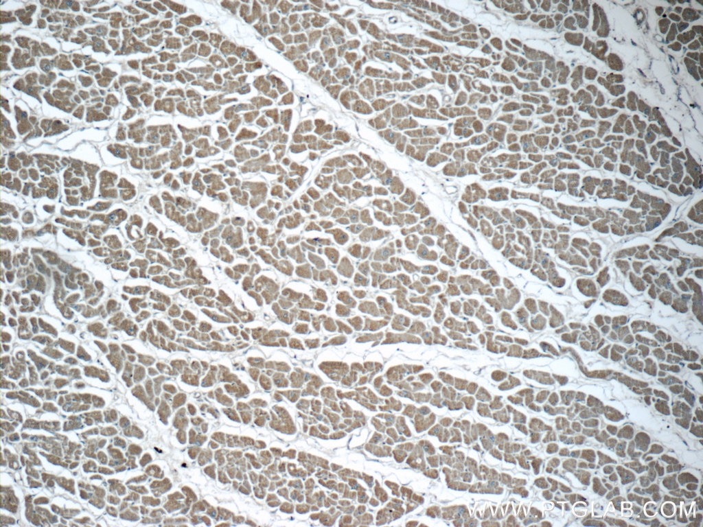 IHC staining of human heart using 23926-1-AP