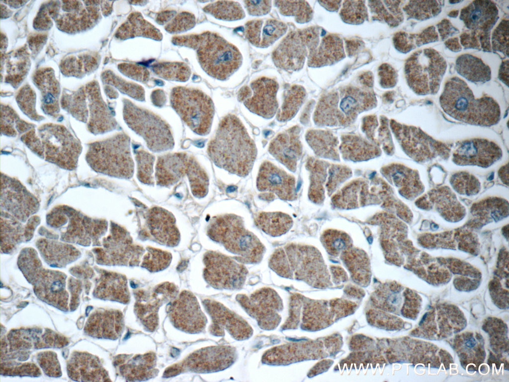 Immunohistochemistry (IHC) staining of human heart tissue using MOK Polyclonal antibody (23926-1-AP)