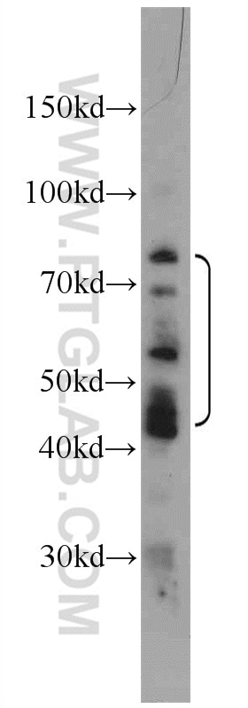 Western Blot (WB) analysis of HeLa cells using MOK Polyclonal antibody (23926-1-AP)