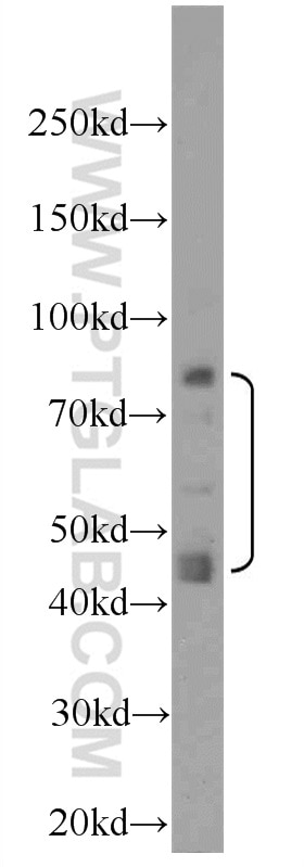 Western Blot (WB) analysis of HeLa cells using MOK Polyclonal antibody (23926-1-AP)