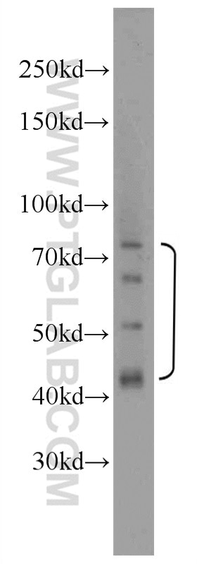 Western Blot (WB) analysis of HepG2 cells using MOK Polyclonal antibody (23926-1-AP)