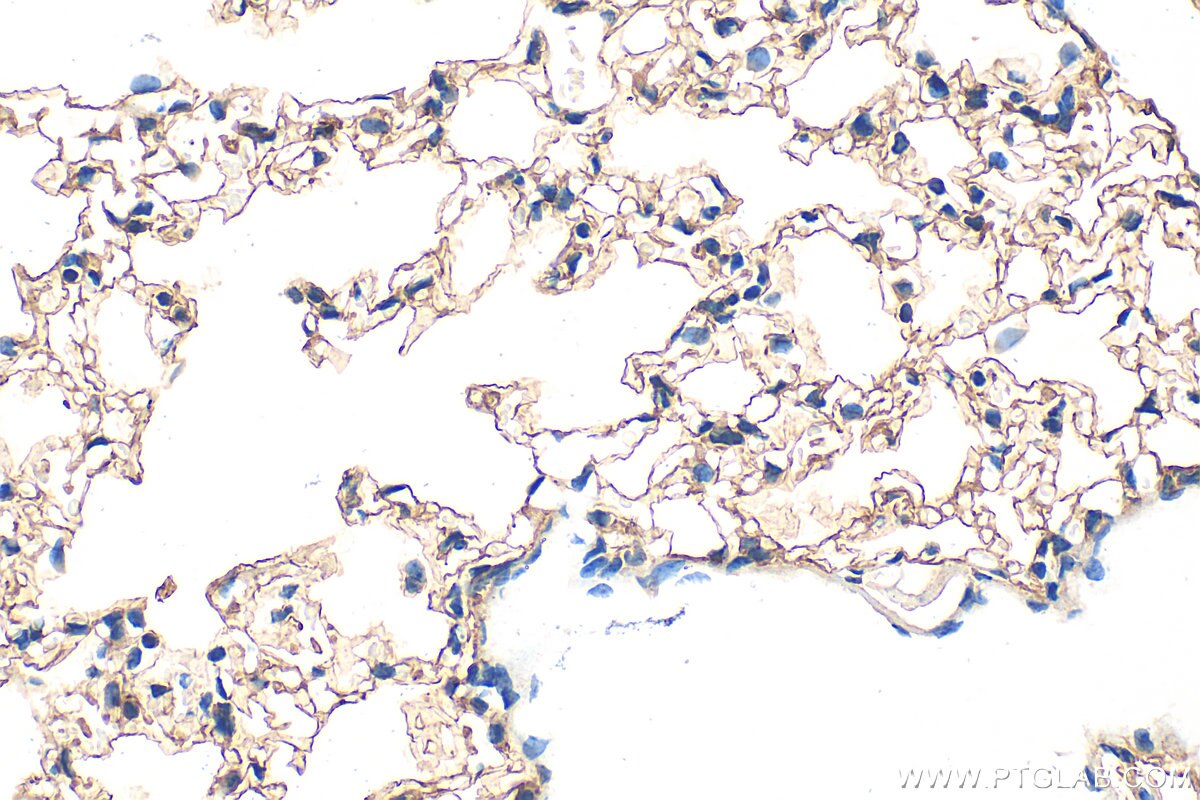 Immunohistochemistry (IHC) staining of mouse lung tissue using RAGE Polyclonal antibody (31122-1-AP)