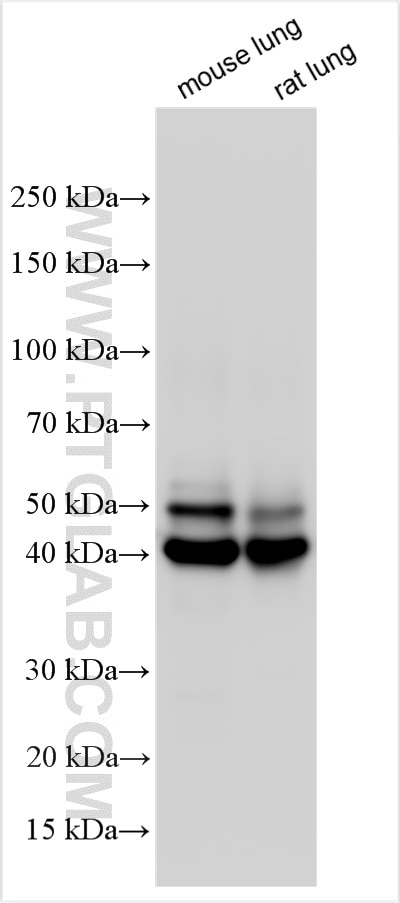Western Blot (WB) analysis of various lysates using RAGE Polyclonal antibody (31122-1-AP)