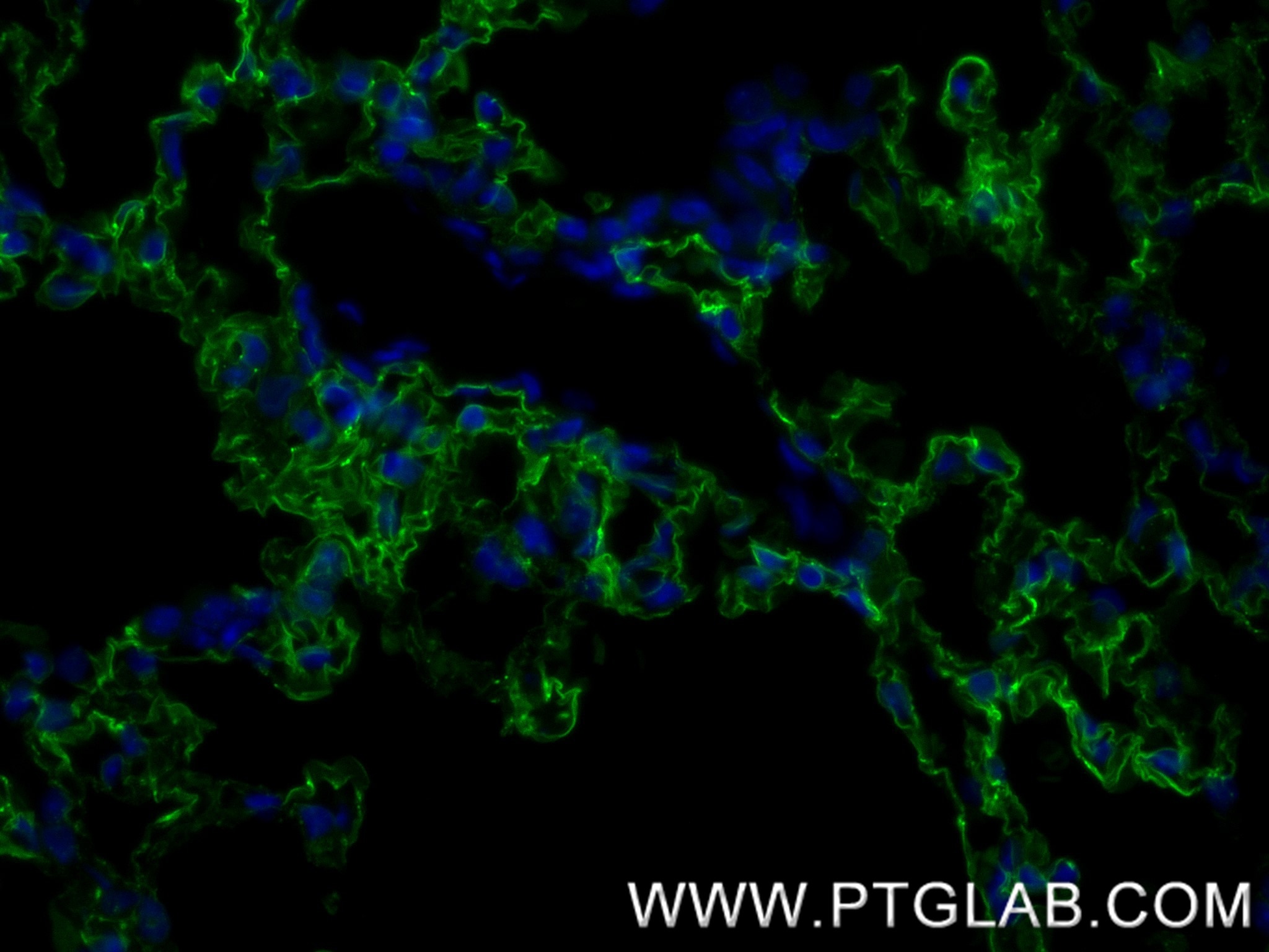 Immunofluorescence (IF) / fluorescent staining of mouse lung tissue using Ager/Rage Recombinant antibody (83742-5-RR)