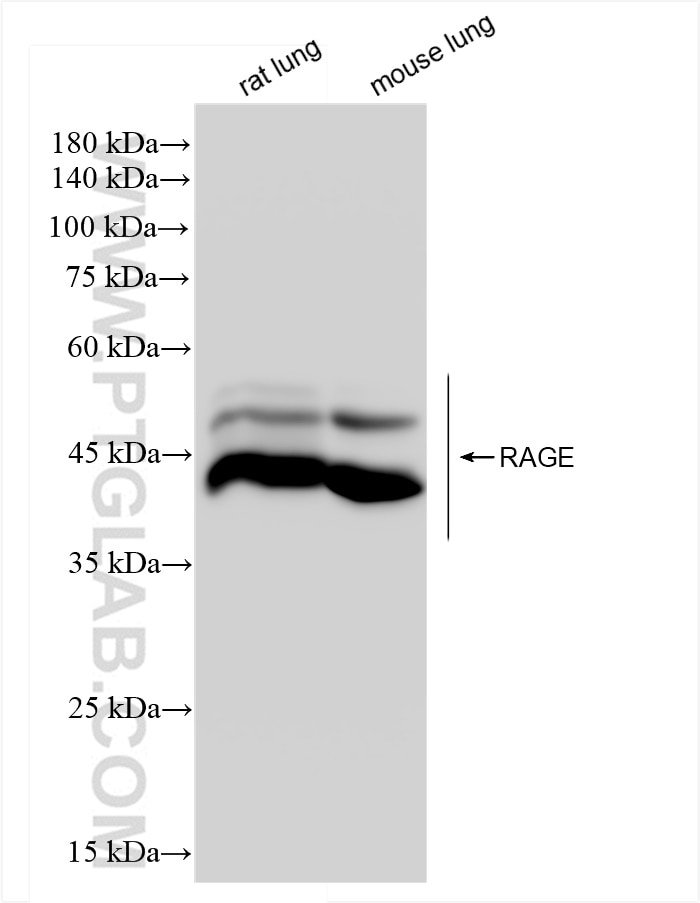 Western Blot (WB) analysis of various lysates using RAGE Recombinant antibody (83742-5-RR)
