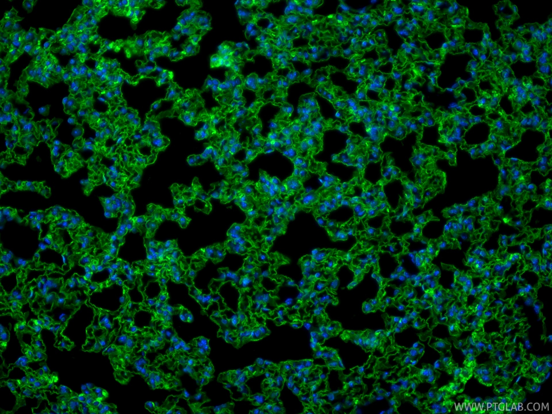 Immunofluorescence (IF) / fluorescent staining of mouse lung tissue using CoraLite® Plus 488-conjugated RAGE Recombinant mon (CL488-83742-5)