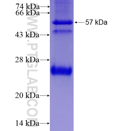 RAGE fusion protein Ag13418 SDS-PAGE