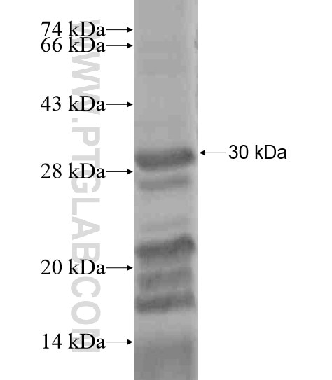 RAGE fusion protein Ag20849 SDS-PAGE