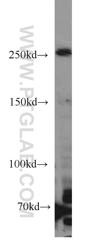 Western Blot (WB) analysis of HeLa cells using RAI1 Polyclonal antibody (17084-1-AP)