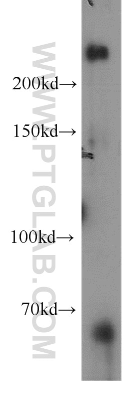 Western Blot (WB) analysis of HeLa cells using RAI1 Polyclonal antibody (17084-1-AP)