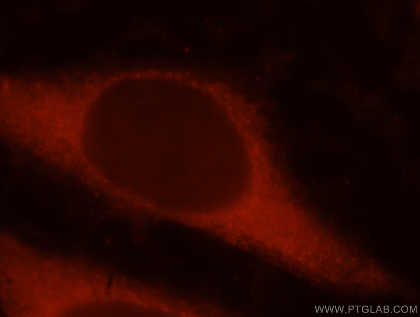 Immunofluorescence (IF) / fluorescent staining of HeLa cells using RAI14 Polyclonal antibody (17507-1-AP)