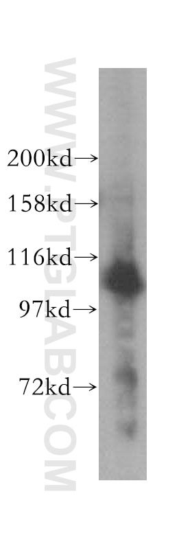 Western Blot (WB) analysis of HeLa cells using RAI14 Polyclonal antibody (17507-1-AP)
