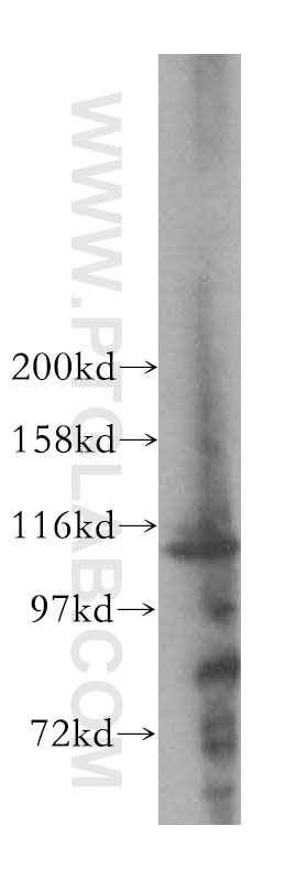 Western Blot (WB) analysis of human placenta tissue using RAI14 Polyclonal antibody (17507-1-AP)