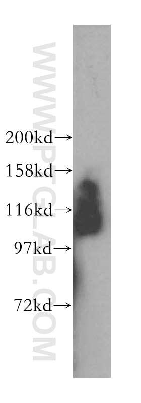 Western Blot (WB) analysis of mouse testis tissue using RAI14 Polyclonal antibody (17507-1-AP)