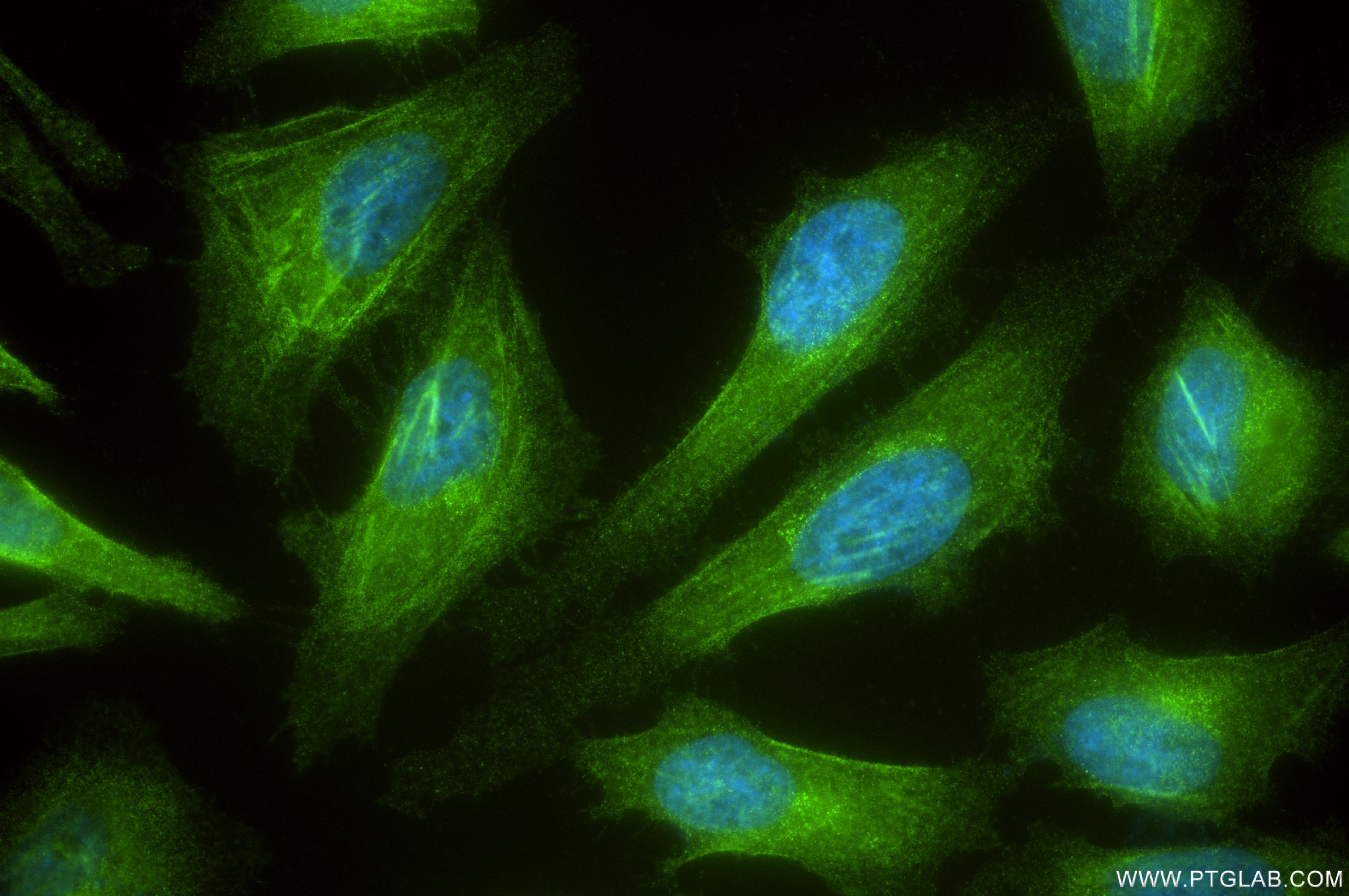 Immunofluorescent analysis of (4% PFA) fixed HeLa cells using RAI14 antibody (86581-1-RR, Clone: 251495G12 ) at dilution of 1:500 and CoraLite®488-Conjugated Goat Anti-Rabbit IgG(H+L) (SA00013-2). This data was developed using the same antibody clone with 86581-1-PBS in a different storage buffer formulation. Immunofluorescence (IF) / fluorescent staining of HeLa cells using RAI14 Recombinant monoclonal antibody (86581-1-RR)