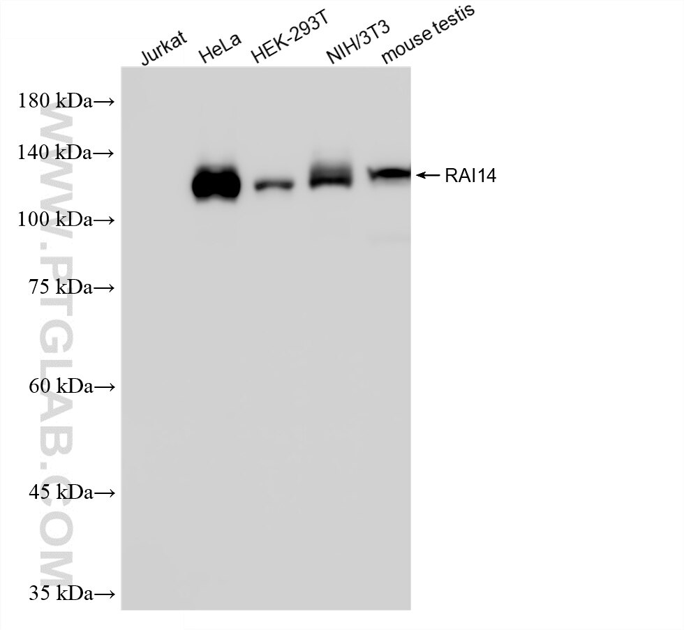 Various lysates were subjected to SDS PAGE followed by western blot with 86581-1-RR (RAI14 antibody) at dilution of 1:10000 incubated at room temperature for 1.5 hours. This data was developed using the same antibody clone with 86581-1-PBS in a different storage buffer formulation. Western Blot (WB) analysis of various lysates using RAI14 Recombinant monoclonal antibody (86581-1-RR)