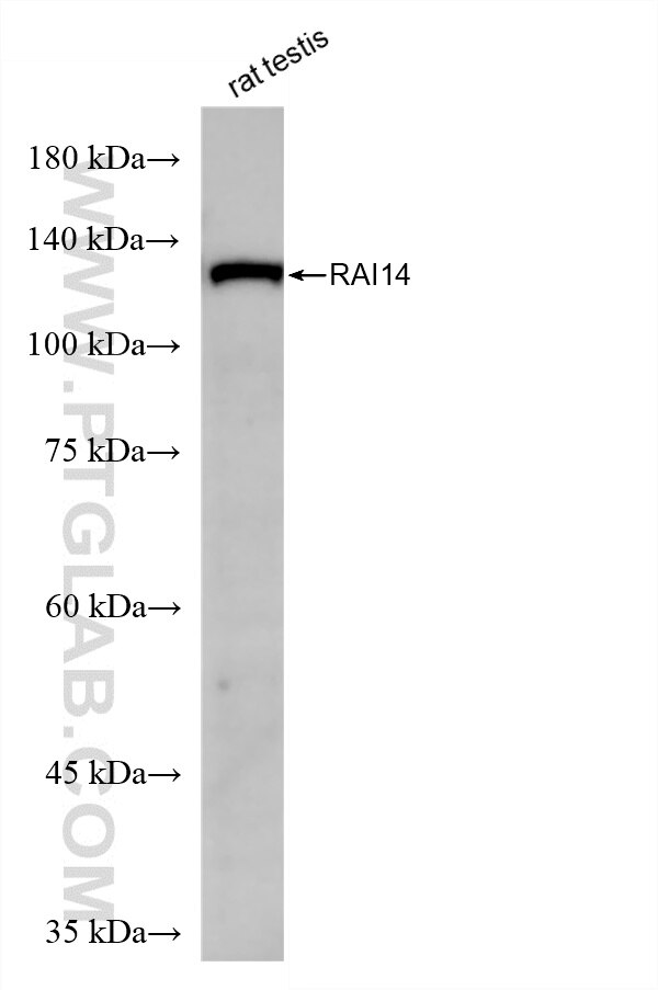 rat testis tissue were subjected to SDS PAGE followed by western blot with 86581-1-RR (RAI14 antibody) at dilution of 1:10000 incubated at room temperature for 1.5 hours. This data was developed using the same antibody clone with 86581-1-PBS in a different storage buffer formulation. Western Blot (WB) analysis of rat testis tissue using RAI14 Recombinant monoclonal antibody (86581-1-RR)